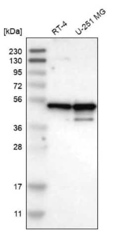 NUDCD3 Antibody, Novus Biologicals:Antibodies:Primary Antibodies